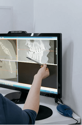 Dr reviewing digital X-Ray for root canal